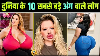 दिमाग हिल जाएगा इन 10 लोगों के Body Parts को देखकर 😯 || Largest Body Parts In The World
