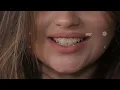 Download Lagu DSD Reklam AzEstetik  Baku Medical Plaza  Rejissor cinemotog  Natiq Axund  Project by Ali Asadov