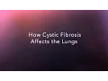 CF Foundation | How does cystic fibrosis affect the lungs?