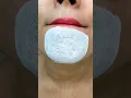 Download Lagu easy way to remove chin Whitehead \u0026 blackhead at home remedy♥️#shorts #youtubeshorts #trendinghacks