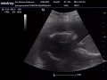 5to. mes nina sartori jauregui