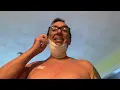 INSPIRE SLEEP APNEA IMPLANT SURGERY
