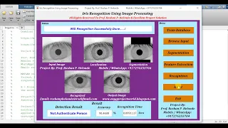 Iris Recognition Using Matlab Project Iris Recognition Using Machine Learning Matlab Code