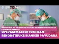 Download Lagu Operasi Mastektomi dan Rekonstruksi Kanker Payudara | Mandaya Breast Advanced Cancer Center (BRAVE)