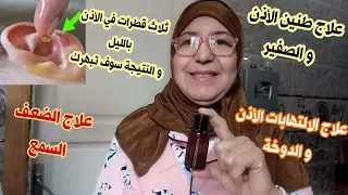 ثلاث قطرات في الأذن بالليل و النتيجة سوف تبهرك علاج ألم في الأذن وطنين الأذن المفاجئ والدوخة  ثلاث قطرات في الأذن بالليل و النتيجة سوف تبهرك علاج ألم في الأذن وطنين الأذن المفاجئ والدوخة