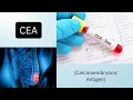 Carcinoembryonic Antigen CEA