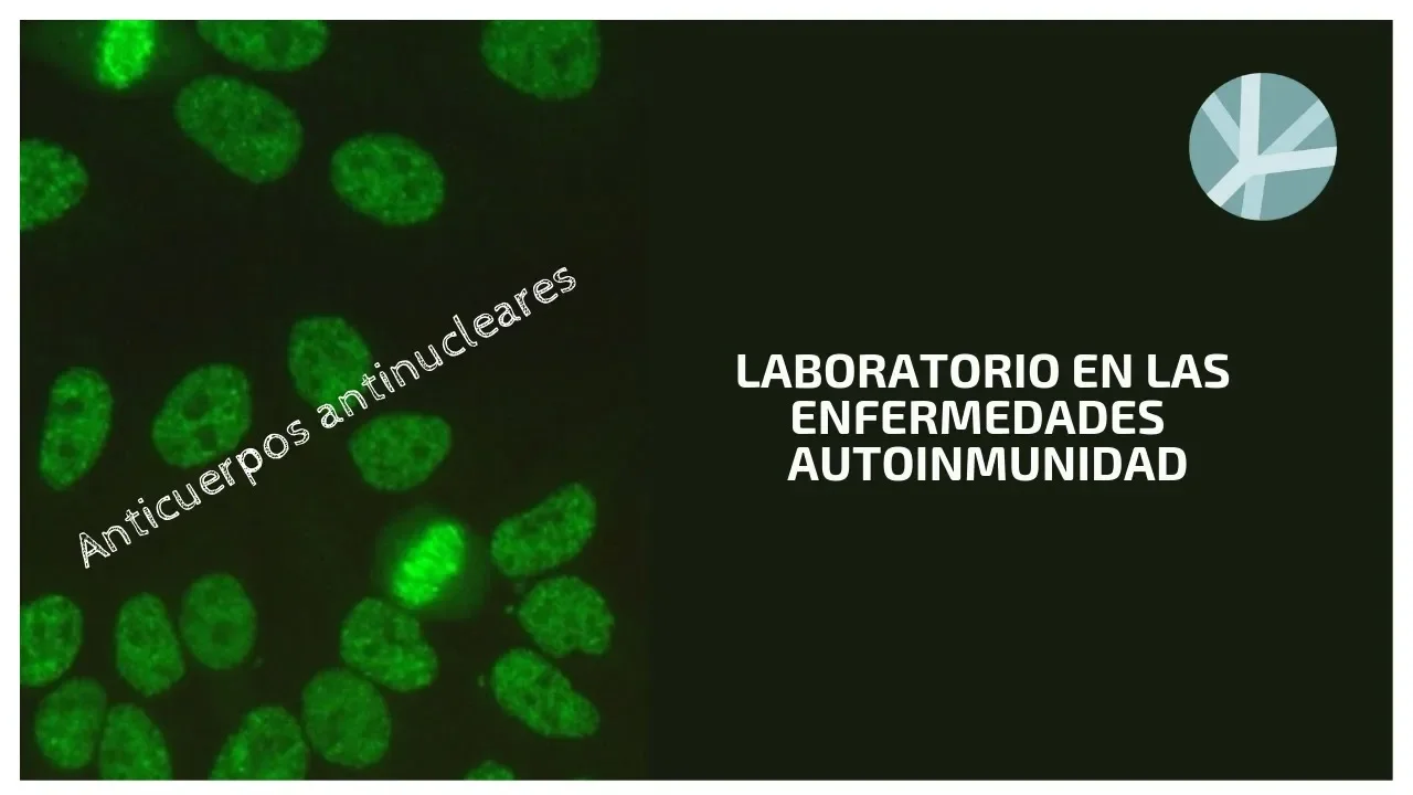 Anticuerpos antinucleares (ANA)