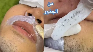 كنز ربانى لإزالة شعر العانة وشعر الوجه والجسم كله من الجذور بدون ألم والشعر سوف يسقط ولن يعود نهائيا 