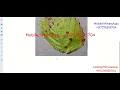 Plant Leaf Disease Identification Using Image Processing Python Project With Source Code