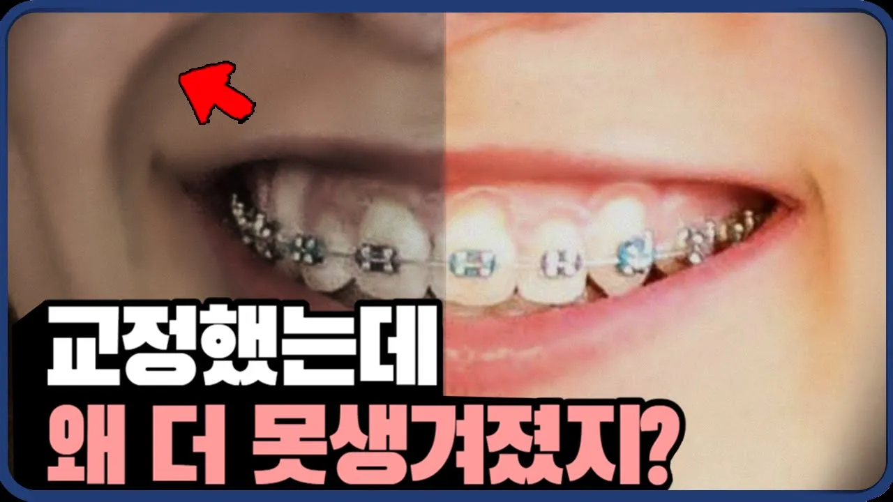 ()팔자주름 걱정 없는 교정, 부작용없는 교정 3가지 ㅣ 강남 치과 원장이 알려드립니다.