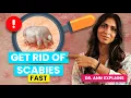 Scabies Treatment How to Apply Permethrin Stop Reinfection Doctor s Top Tips