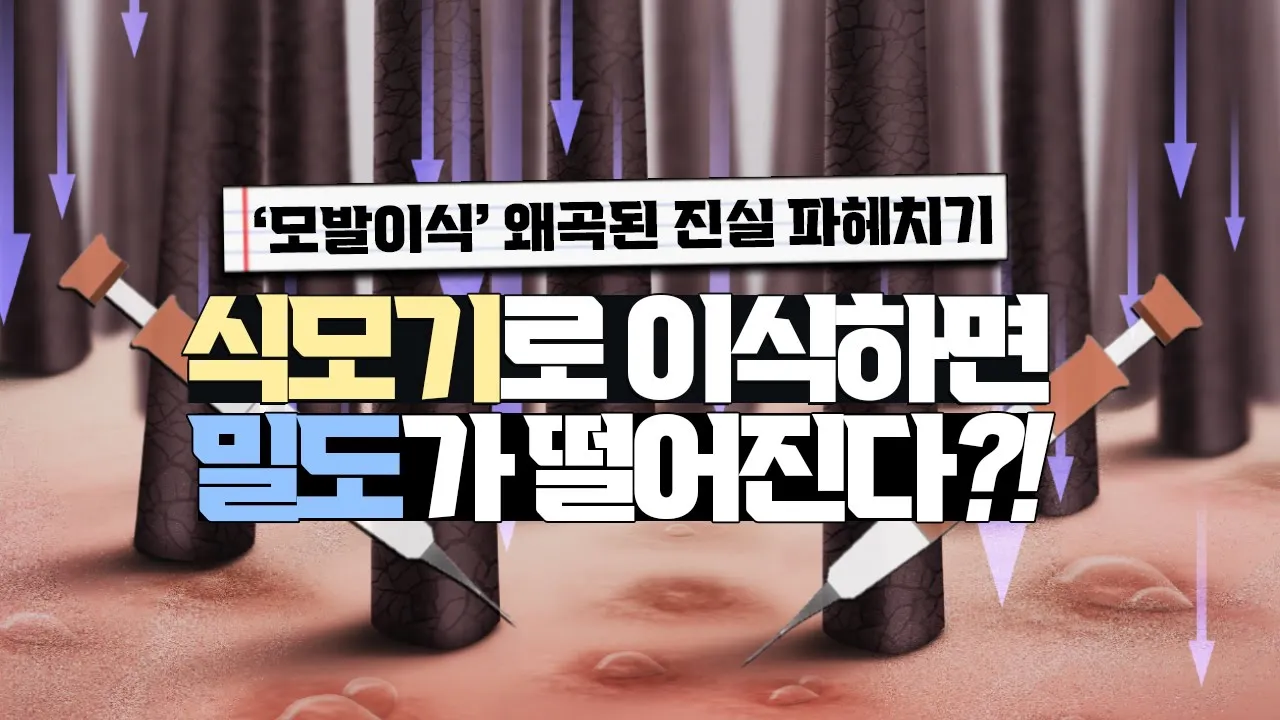 의느님답변📂 식모기로 이식하면 밀도가 떨어진다는데요?! 사실인가요!ㅣ다나성형외과(DANA)ㅣ모발이식ㅣ헤어라인교정