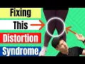 Pronation Distortion Syndrome Pes Planus Distortion Syndrome How To Fix Them