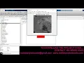 Image Rain Removal Using RCNN