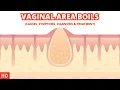 Download Lagu Dealing with Vaginal Area Boils: Tips and Advice for Fast Relief