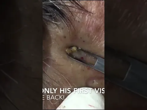 A Satisfying Extraction You Can't Miss