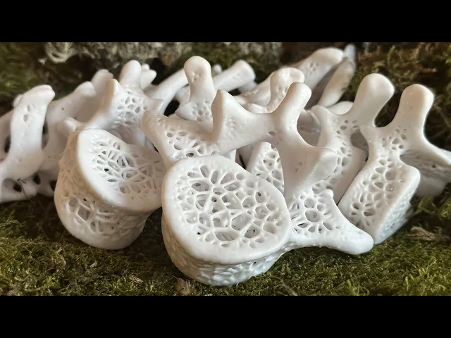 Voronoi Vertebrae (thoracic) video thumbnail
