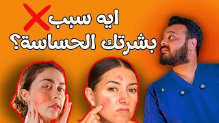 البشرة الحساسة   نصائح للعناية   البشرة الحساسة حالة وليست نوع بشرة دندنها