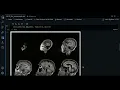 0 0 - ANTsPy review