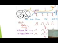 6 Quick Reviews EMG and Nerve Conduction Study