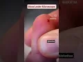 Human Blood Under Microscope Watch All the Blood Cells