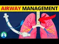 Airway Management Medical Definition and Overview