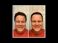 David Venable Weight Loss
