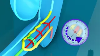 3D Midgut Embryology - Rotation of Midgut in 3D - Physiological Umbilical Hernia and Intestines