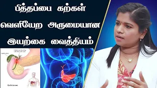  gallbladder stone removal natural way