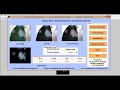 Matlab Code for Mango Plant Disease Detection using Neural Network