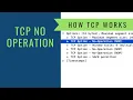 How TCP Works - No Operation Option
