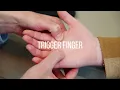 Trigger Finger Symptoms Causes and Treatment