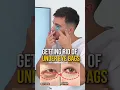 Removing UNDER EYE BAGS