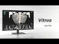 Download Lagu Geautomatiseerde Vitrea-workflow – Open rib | Uitgevouwen ribweergave