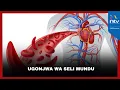 Download Lagu Kona ya afya: Ugonjwa wa Seli Mundu