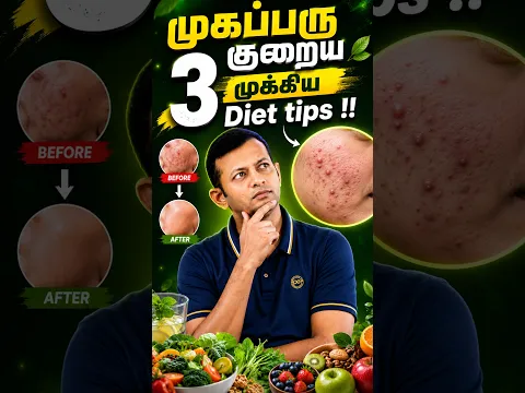 #shorts முகப்பரு குறைய 3 முக்கிய Diet tips !! | Dr. Arunkumar