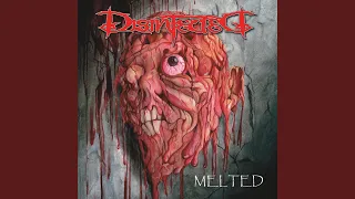 Download Melted MP3