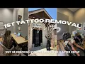 I Regret My Tattoos Starting Laser Tattoo Removal Full 1st Experience