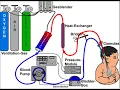 ECMO CPT codes - simplify medical coding