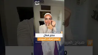 لا تضيعي وقتك في التجربة والخطأ المعايير الأساسية لاختيار كريم فع ال للهالات السوداء تحت العين  لا تضيعي وقتك في التجربة والخطأ المعايير الأساسية لاختيار كريم فع ال للهالات السوداء تحت العين