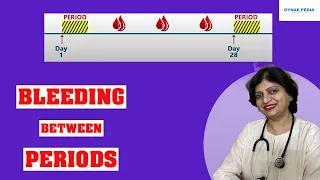 Download Intermenstrual Bleeding | Periods ke beech mein bleeding |Hindi| Dr Neera Bhan MP3