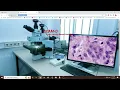 Project Skin Cancer Detection Machine Learning Python Django Website localhost on Mobile