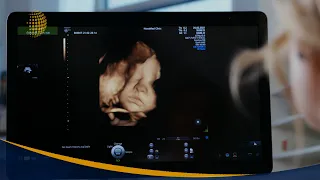 “PLATÓN PROABORTO”, SE VE OPACADO POR UNA DIPUTADA PRO VIDA
