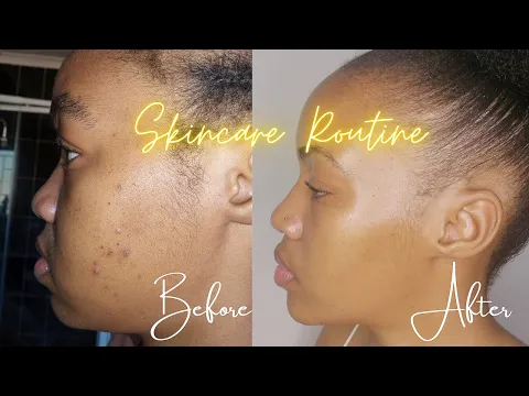 Download MP3 My skincare routine for acne | Under R50! | South African YouTuber