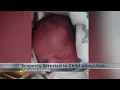 The latest on what led to authorities finding missing Wisconsin Rapids baby