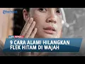 Lagu 9 Cara Menghilangkan Flek Hitam di Wajah Secara Alami
