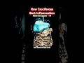 Download Lagu Hoe kruisbloemige ontstekingen kunnen voorkomen! #gezondheid #levensstijl #feiten #wetenschap #sh...