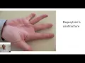 Signs of Liver Failure liver Dr Arvind Kumar