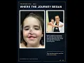 From Hungary to Michigan Aliz s Remarkable Facial Reconstruction Journey