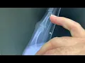 Finger joint dislocation or How to treat a dislocated finger - good advice from a hand surgeon
